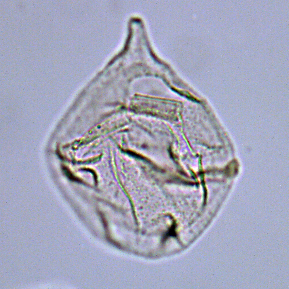 Isabelidinium acuminatum, U1581-23R-5W, 101-106, sl. 1, Q20-1, foto-a.jpg